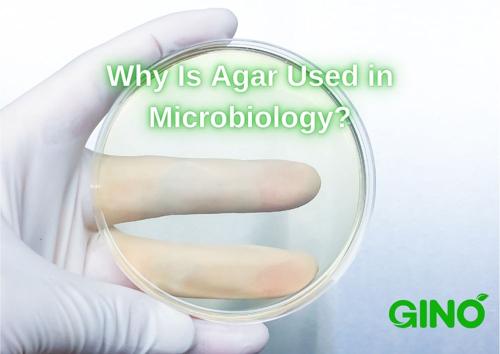 Why Is Agar Used in Microbiology